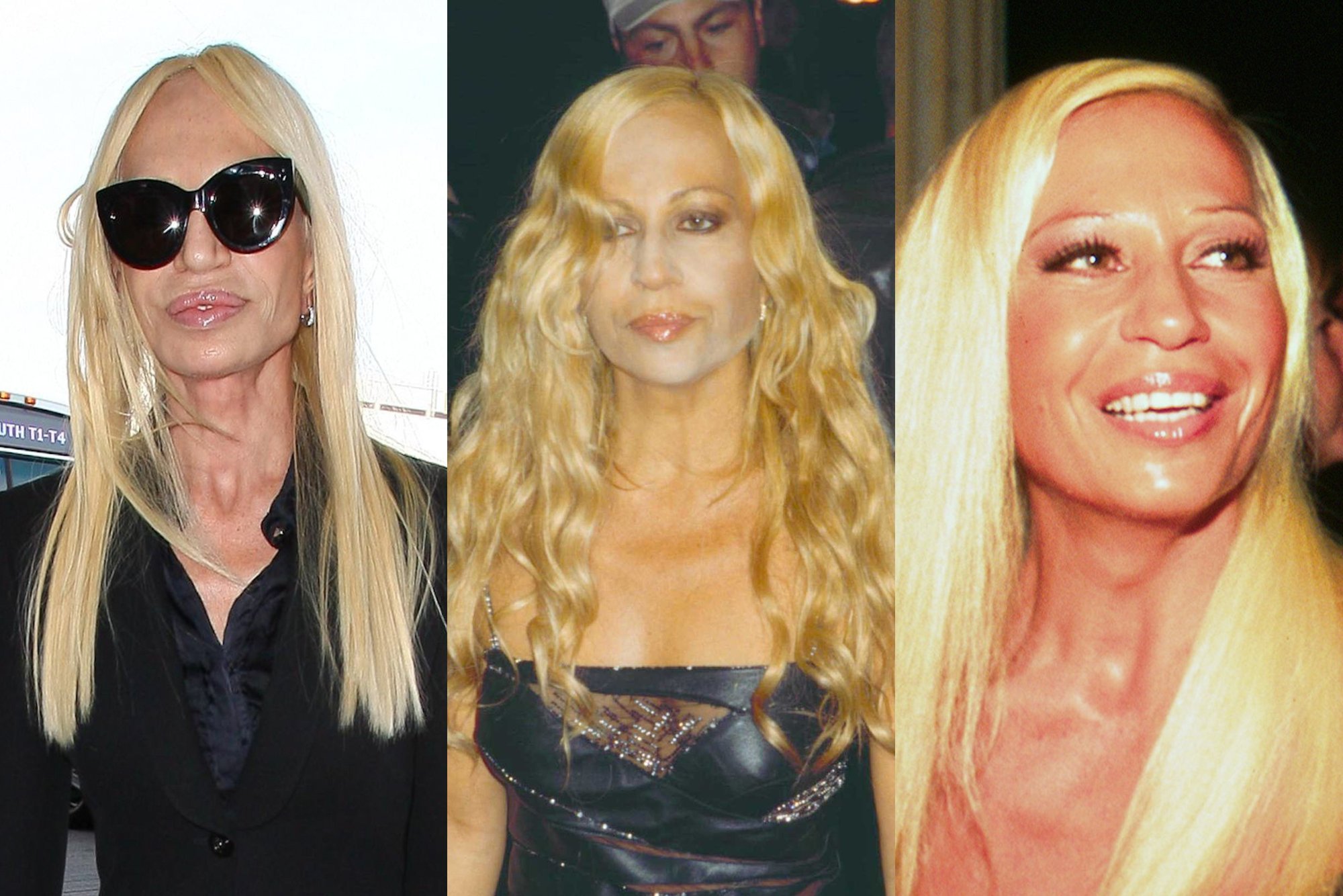 希少レアVERSACE DONATELLA VERSACE Savo išvaizdą plastinėmis operacijomis tobulinusi Donatella