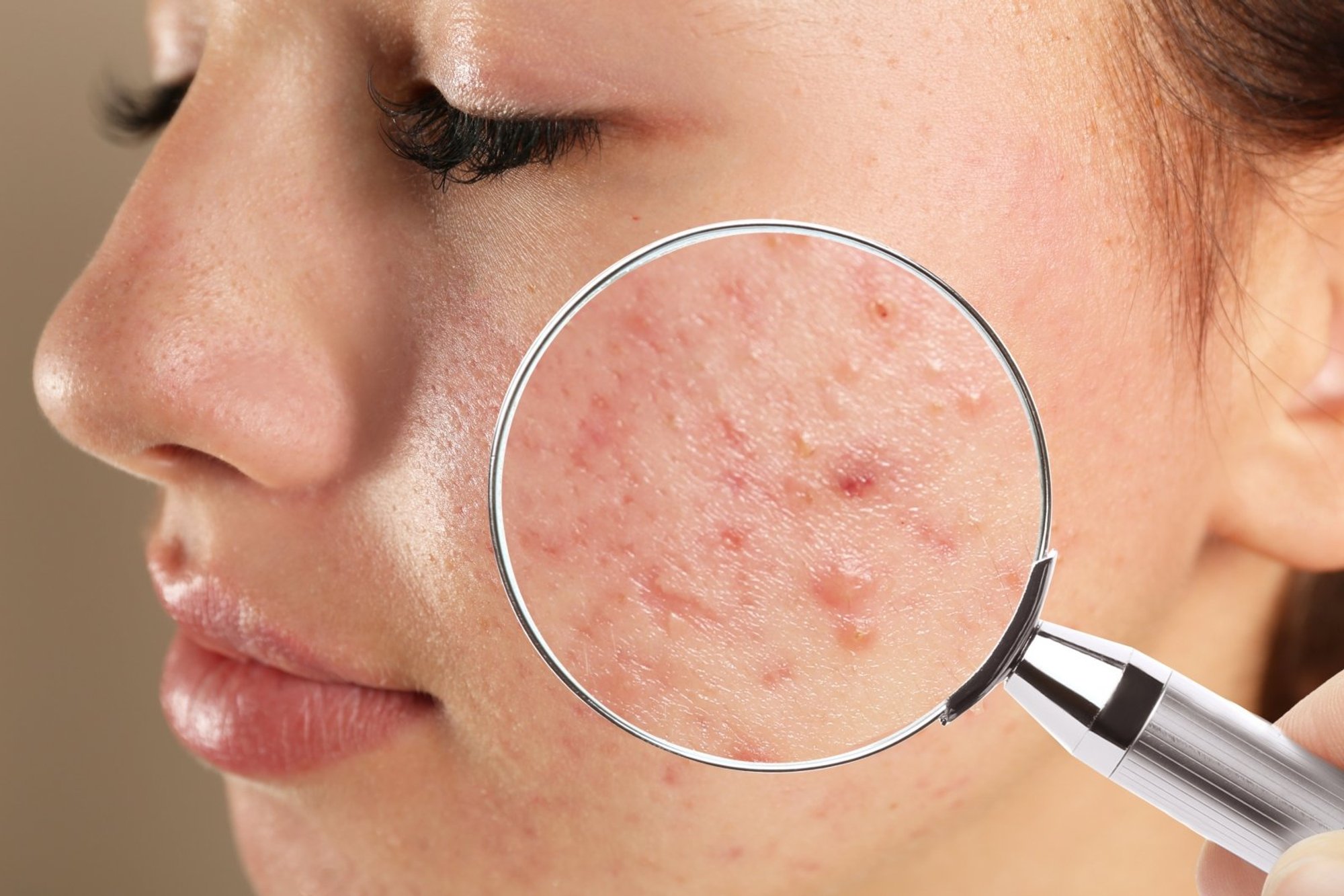 Skin Signals: Expert Explains What Acne, Itching, and Rashes Reveal About Your Health