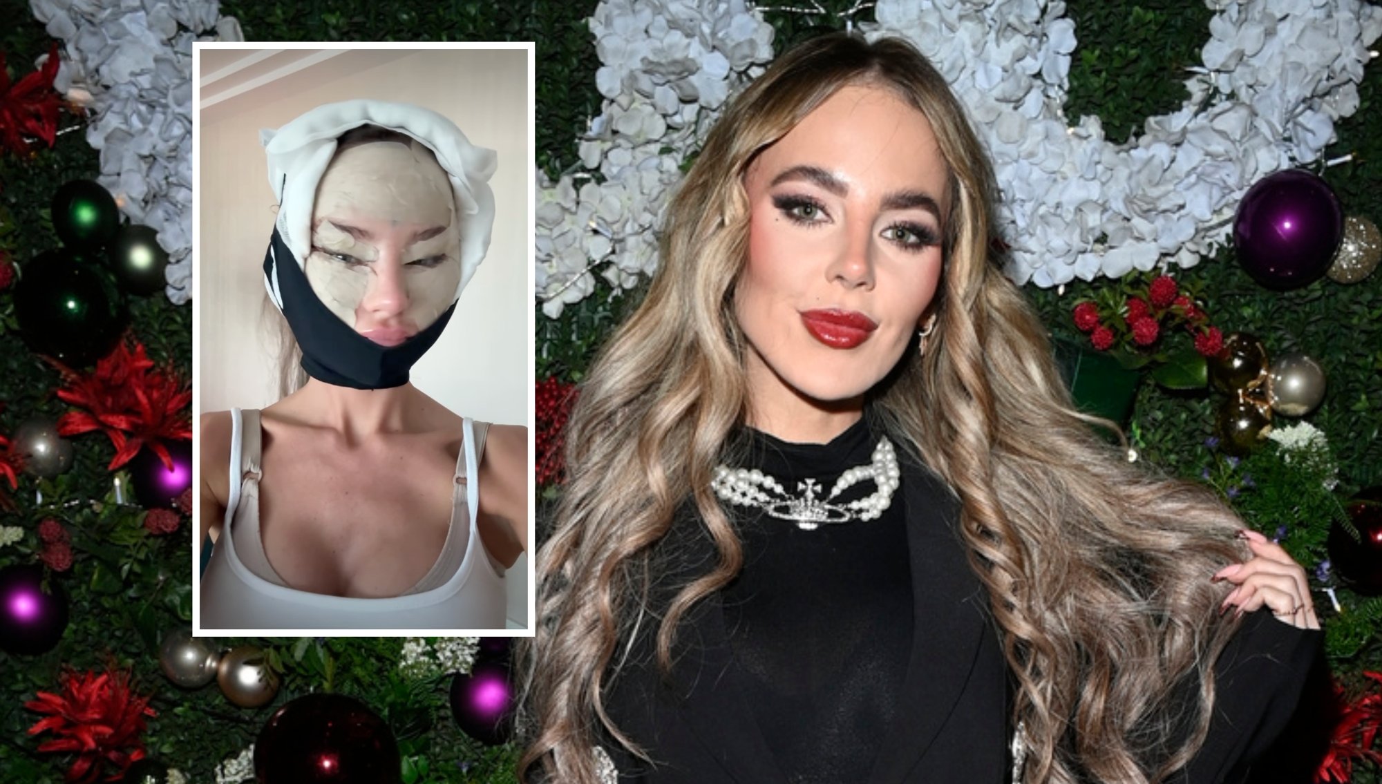 Influencer Shows Face After Cosmetic Surgery in Turkey, Reports Smooth Recovery