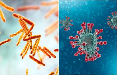 Kairėje - tuberkuliozę sukelianti bakterija, dešinėje - COVID-19 sukeliantis virusas