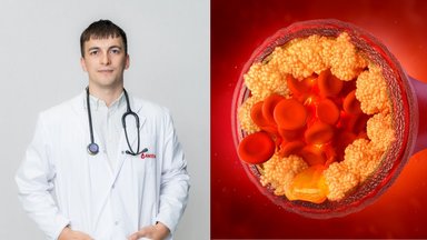 Sveikai maitinatės, sportuojate, bet cholesterolis vis tiek didelis: paaiškino, kodėl taip būna