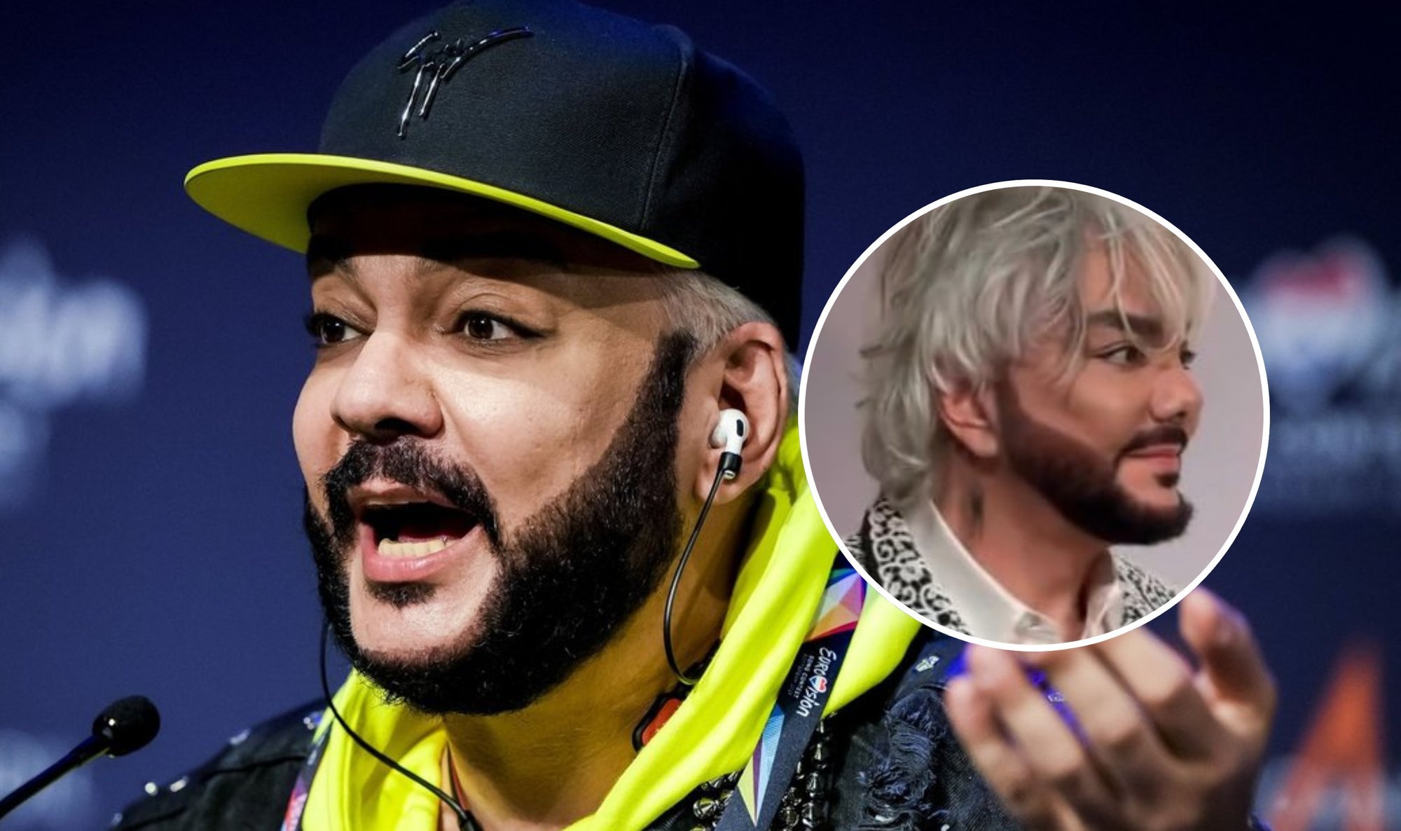 Philipp Kirkorov's new face mocked as 'short-nosed Ken' after surgeries