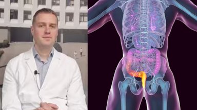 Nemalonūs pojūčiai išangėje gali rodyti delikačią problemą: gydytojas ragina ją būtinai išspręsti