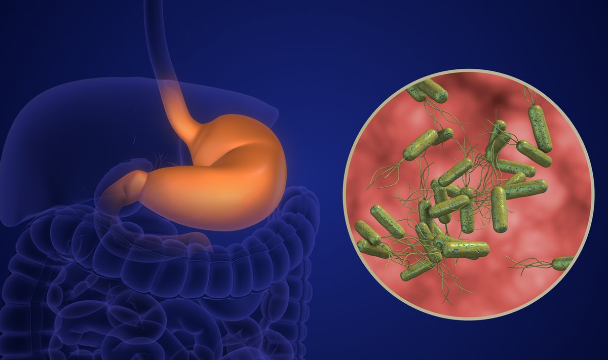 Helicobacter Pylori