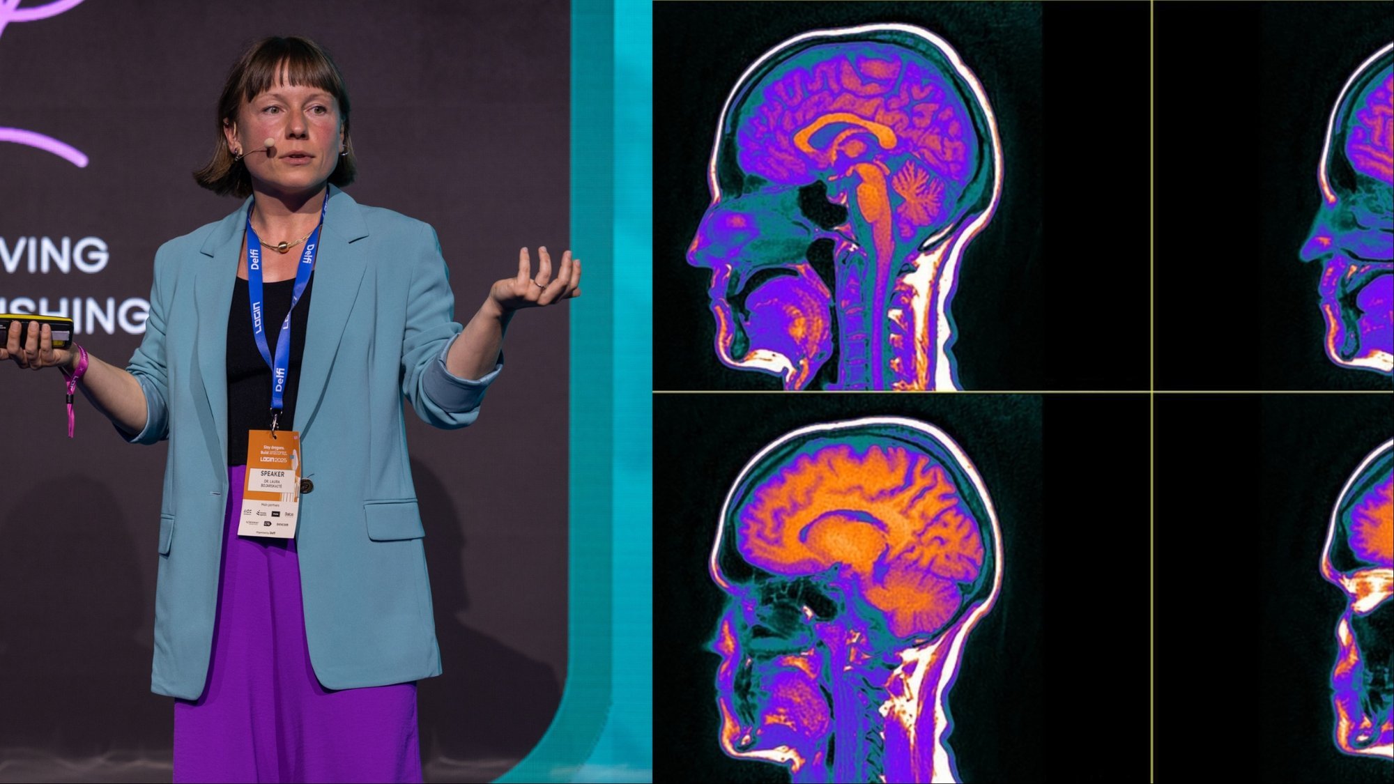 Mokslininkė išvardijo, kokie įpročiai silpnina mūsų smegenis: regis – tik smulkmenos