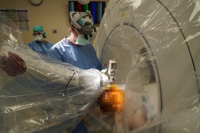 Pirmoji robotinė giliojo smegenų stimuliatoriaus implantacija Arkanzaso istorijoje