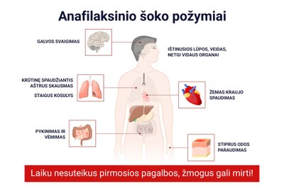 Anafilaksinio šoko požymiai