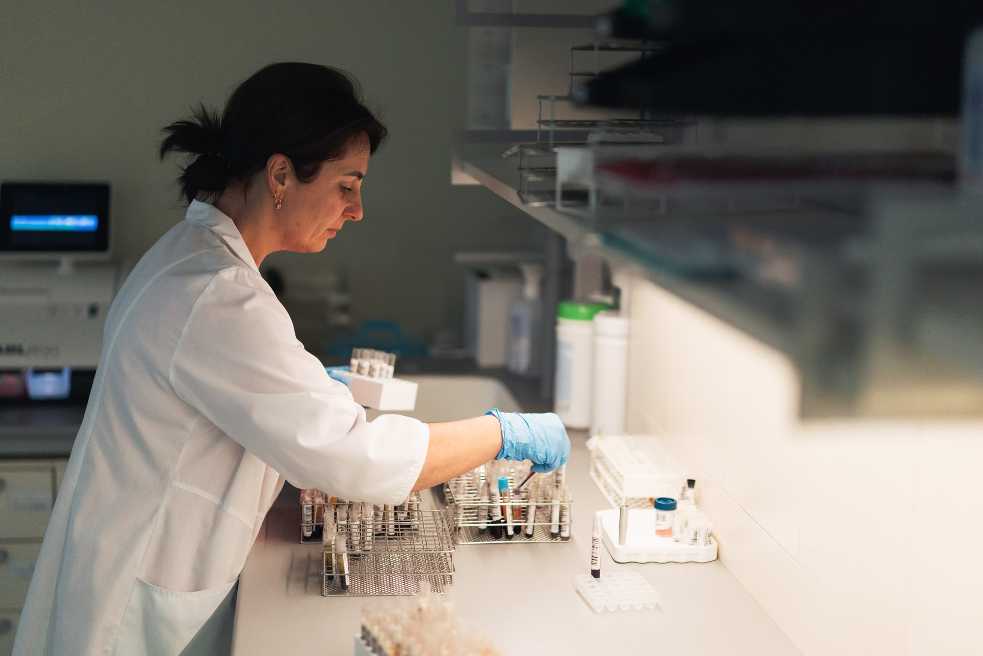Chronic Hepatitis C cases increase due to free screening