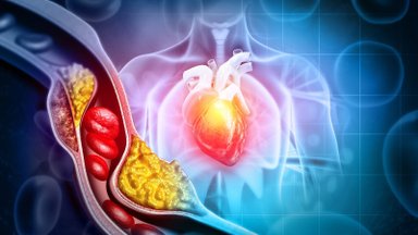 Ar tikrai visas cholesterolis yra geras?