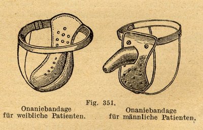 Nuo masturbacijos „saugantys“ diržai – merginoms ir vaikinams.