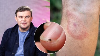 Gydytojas Morozovas: 3 Laimo ligos stadijos ir kada tyrimai nieko neparodys